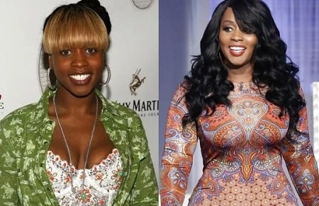 A before and after picture of Remy Ma hinting breast implantation.